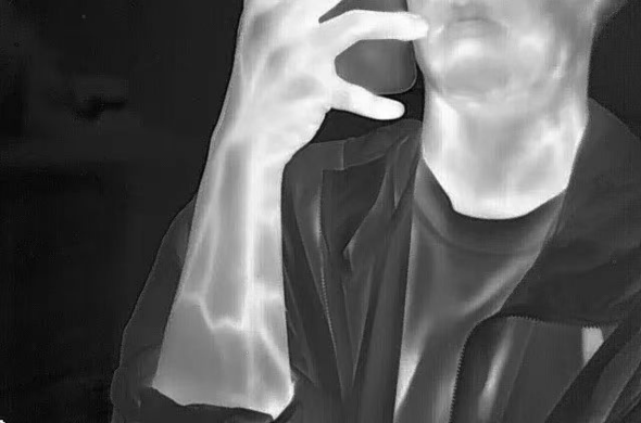 Top Considerations When Choosing a Medical Diagnostic Thermal Camera OEM