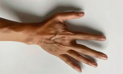 Medical Diagnosis